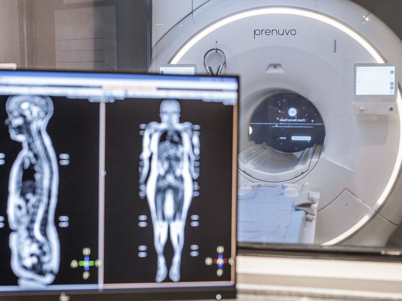 Celebrities are getting ,000 MRI scans to learn about their health. Should you?